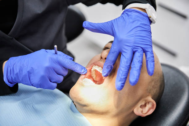 Best Emergency Tooth Extraction in Allyn, WA